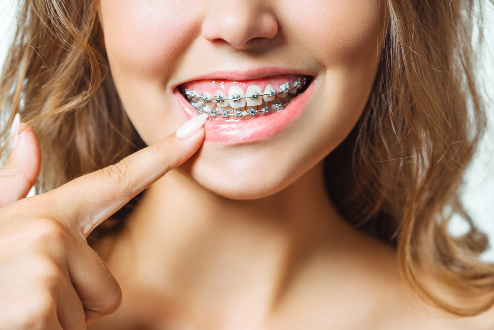 6 Month Smiles®