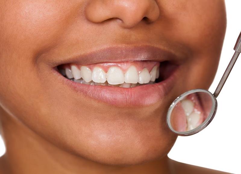 Orthodontic Appliances
